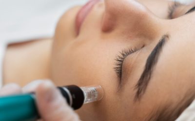 Rejuvenate Your Skin: Discover the Magic of Microneedling Treatment and Its Fantastic Boosters