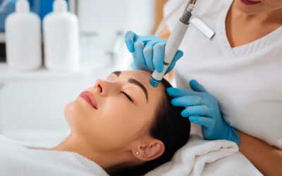 What Makes HydraFacial Effective for Acne-Prone Skin?